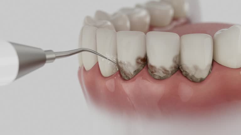 Trusted Invisalign Clear Aligners service in St. Johns, MI - Dentist Open Now
